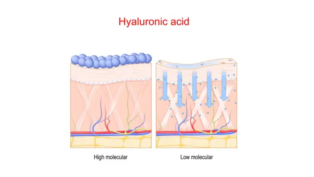 Atok Hyaluronový fluid