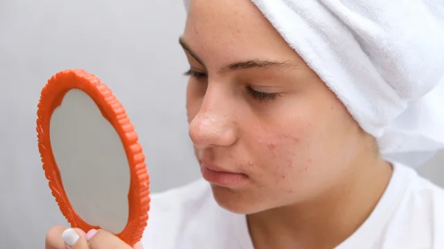 Kosmetika pro problematickou pleť